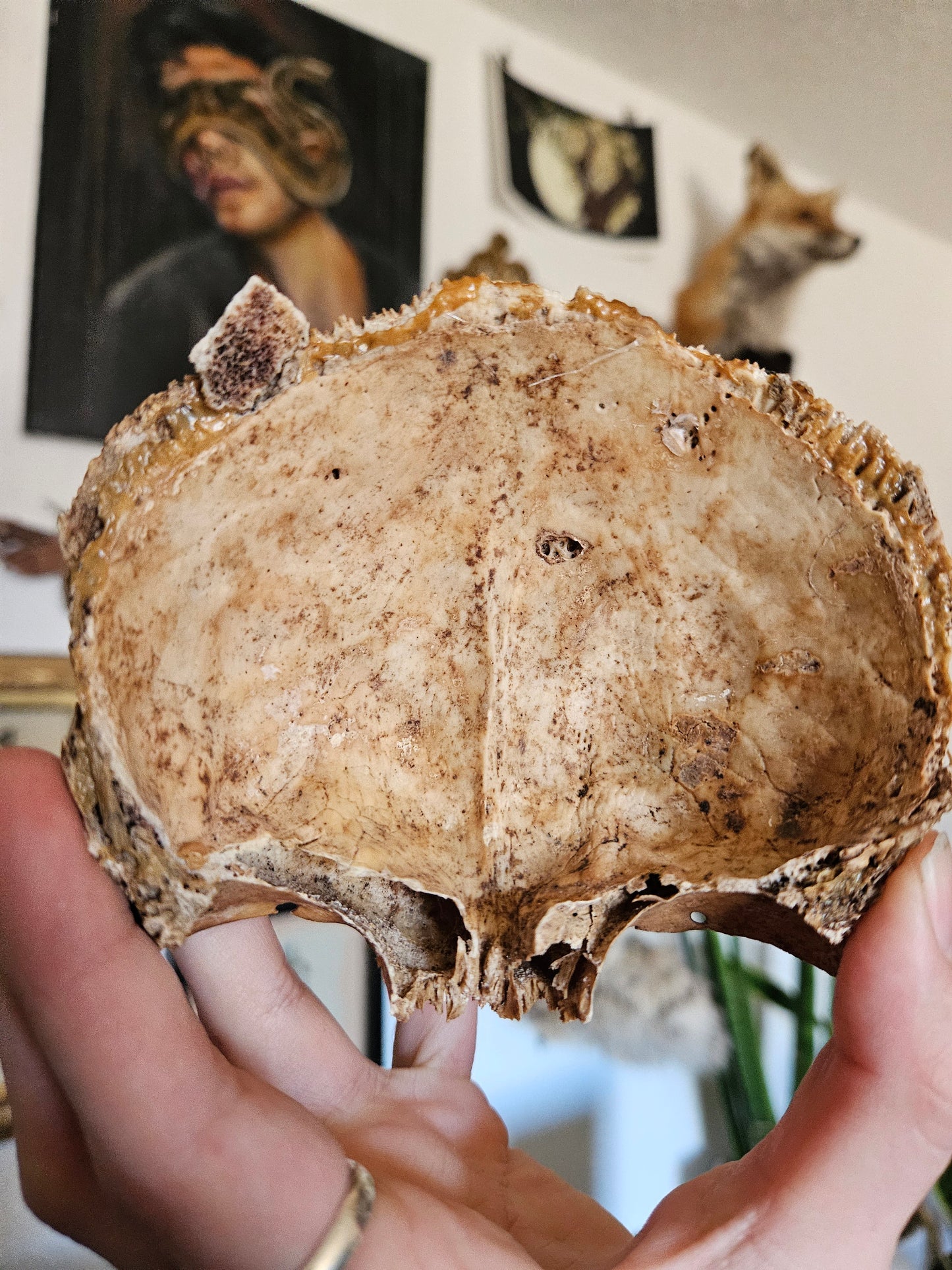 Partial hooman frontal lobe