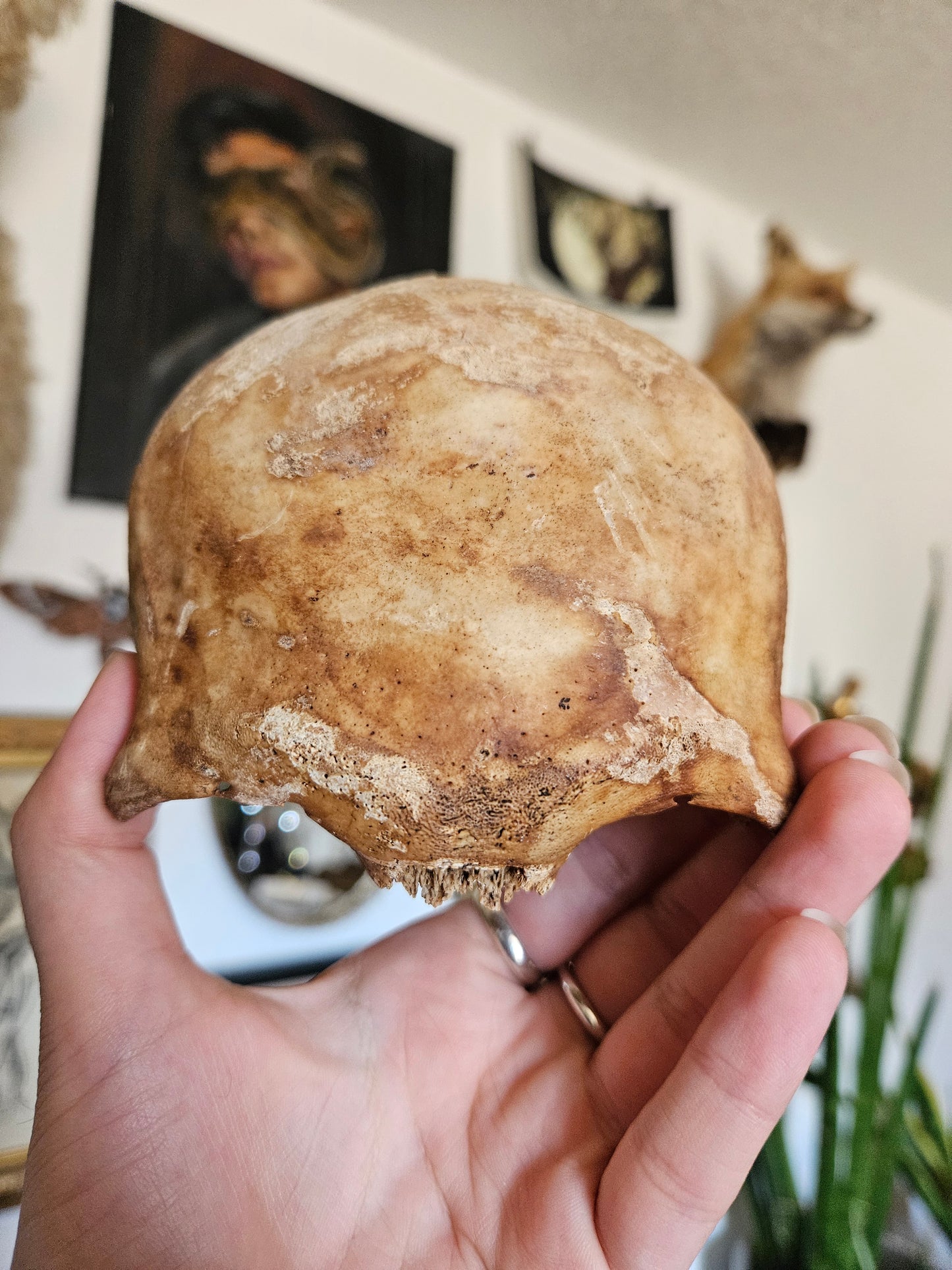 Partial hooman frontal lobe