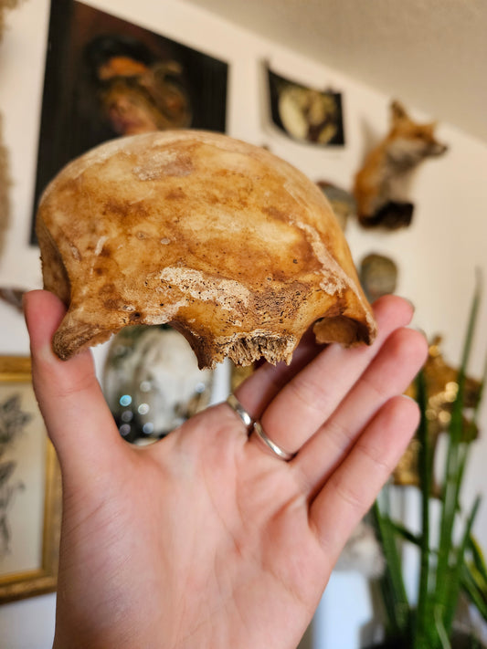 Partial hooman frontal lobe